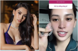 Để hoàn thiện vẻ xinh đẹp, Hoa hậu Tiểu Vy thú nhận thay đổi nhẹ chi tiết này trên gương mặt