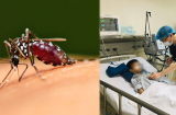 Bé 5t liệt tứ chi vì căn bệnh nguy hiểm ở não có thể lây qua vết muỗi đốt: Cha mẹ đừng chủ quan