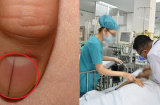5 dấu hiệu bất thường ở ngón tay cảnh báo bệnh nguy hiểm, hãy đến gặp bác sĩ ngay