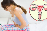 4 dấu hiệu cảnh báo tử cung của bạn không khỏe, nên đi kiểm tra sớm