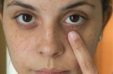 3 biểu hiện trên khuôn mặt nữ giới ngầm cảnh báo tử cung đang có vấn đề