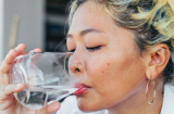 5 thói quen uống nước dễ gây lão hóa hơn cả thức khuya, 3 cái đầu tiên nhiều người mắc phải