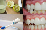 6 cách làm sạch cao răng tại nhà từ nguyên liệu tự nhiên, răng trắng bóng, giảm hôi miệng