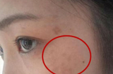 4 biểu hiện trên khuôn mặt chứng tỏ nữ giới bị viêm nhiễm phụ khoa, có 1 cũng cần đi khám gấp