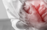 6 cơn đau trên người cảnh báo nhồi máu cơ tim từ sớm: Người trẻ cũng có thể gặp, biết để tự cứu mình