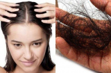 Rụng tóc nhiều đến mấy cứ thử 7 mẹo dân gian: Tóc giảm rụng nhanh chóng, mọc chắc khỏe trở lại