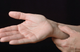 6 dấu hiệu trên bàn tay dự báo cuộc đời vất vả, khó tụ tài, hậu vận nghèo khó