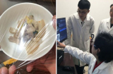 Không còn nghi ngờ, 6 món ăn dễ gây K đầu bảng: Đồ để qua đêm đứng thứ 4, nhà nào cũng có