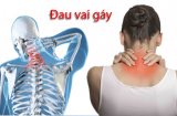 Đau vai gáy nhiều người nhầm tưởng do xương khớp thoái hóa: Hãy cẩn trọng, có thể gan, phổi của bạn đang 'kêu cứu'