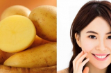 5 cách làm mặt nạ khoai tây trị mụn, dưỡng trắng da giúp bạn gái thêm phần tự tin