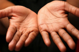 Bàn tay có 1 trong 5 đặc điểm này, cuộc đời vất vả, làm mãi vẫn nghèo