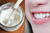 Trộn kem đánh răng với thứ này: Sạch cao răng, hết viêm lợi, hôi miệng