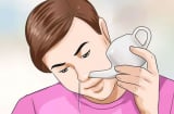 6 cách đơn giản giúp bạn ngưng chảy nước mũi ngay lập tức tại nhà vô cùng hiệu quả