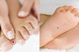 3 nốt ruồi trên bàn chân tượng trưng cho  Tài - Lộc - Phát ai có 1/3 cũng đủ viên mãn trọn đời
