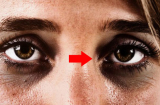 Các cụ dạy cấm sai: Người hai mắt trũng sâu thâm đen, xám xịt chớ lại gần, vì sao vậy?