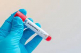 Trẻ nhiễm Adenovirus tăng nhanh: Khi có dấu hiệu ho sốt, cần làm xét nghiệm gì để biết có nhiễm Adenovirus không?