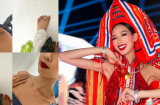 Á hậu Bảo Ngọc gây lo lắng khi bị bầm dập khắp nơi trên cơ thể trước thềm Chung kết Miss Intercontinental