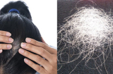 Lý do không nên nhổ tóc bạc: Có 4 cái hại lớn ai cũng cần biết