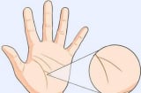 Bàn tay có 1 trong 4 dấu hiệu này chủ nhân đen đủ đường cẩn thận đau ốm tai ương, mất cả cơ ngơi?