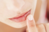 5 mẹo che giấu khuyết điểm môi thâm mà chị em nào cũng nên nắm rõ