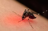 Mẹo đuổi muỗi đơn giản, an toàn: Không cần tốn sức muỗi cũng tự động bay đi hết