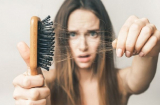 7 chiêu đơn giản giúp giải quyết tình trạng tóc khô xơ gãy rụng trong thời gian ngắn