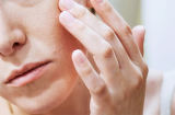4 loại mặt nạ cải thiện tình trạng da bị khô sần, thô ráp