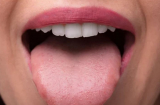 Lưỡi là 'thước đo' sức khỏe: Nếu 4 thay đổi này không xuất hiện thì chứng tỏ sức khỏe bạn đang rất ổn định