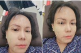 Việt Hương tiết lộ tình trạng sức khỏe hiện tại sau sự cố bị méo một bên mặt