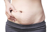 6 mẹo phục hồi da bụng chảy xệ kém săn chắc, chị em nên tham khảo để cải thiện tình hình