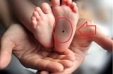 Trẻ sinh ra có nốt ruồi ở 3 vị trí này: Tương lai tươi sáng, sớm thành tài cha mẹ hưởng phước thơm