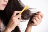 Bật mí tips chọn dầu gội phù hợp để đối phó với tình trạng tóc rụng như lá mùa thu