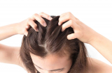 Nguyên tắc chăm sóc da đầu khỏe mạnh để nuôi dưỡng mái tóc dày óng ả và chắc khỏe