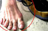 Các cụ nói: 'Ngón chân thứ hai dài hơn ngón cái, lớn lên không hiếu thuận', có đúng không?
