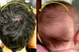 Xoáy tóc trên đầu có thể tiết lộ vận mệnh tương lai, đếm xem con bạn bao nhiêu xoáy?