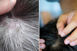 Lý do không nên nhổ tóc bạc: Có 3 cái hại lớn, không phải ai cũng biết