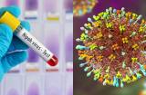 WHO cảnh báo một đại dịch toàn cầu có thể xuất hiện do virus Nipah