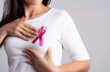 Phụ nữ có vòng 1 lớn thì dễ bị ung thư vú?Thông tin từ chuyên gia chị em nhất định phải lưu tâm