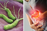 4 dấu hiệu chứng tỏ cơ thể có vi khuẩn HP, ăn 5 món vi khuẩn HP 'sợ nhất' để bảo vệ dạ dày