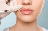 Xóa nếp nhăn bằng tiêm Botox và Filler - phương pháp nào an toàn và tốt hơn?