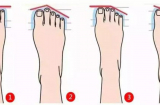 Bàn chân có 1 trong 6 đặc điểm này, người sở hữu mang số đại gia, chuẩn hơn nhìn mặt