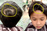 Trẻ nhỏ có 2 xoáy tóc rõ trên đầu sẽ càng thông minh hơn, bác sĩ nói gì?