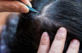 3 mối nguy hại khôn lường từ việc nhổ tóc bạc