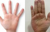 Lòng bàn tay nói lên tuổi thọ: Bác sĩ chỉ 3 đặc điểm báo hiệu người sống lâu