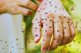 Mẹo đơn giản giúp giảm ngứa cực nhanh khi bị muỗi và côn trùng đốt