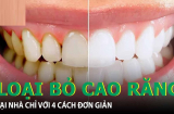 Cao răng bám đầy, vàng ố mấy chỉ cần làm cách này là bong ra hết, răng trắng khỏe