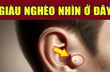 Người có nốt ruồi trên dái tai đường công danh Tiền Tài có thuận?