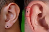 Ai sở hữu nốt ruồi ở vị trí này thì cả đời được quý nhân phù trợ, không bao giờ lo hết tiền