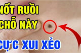 3 nốt ruồi phá của: Đặc biệt vị trí thứ nhất, hai hụt tiền bạc, bỏ ngay trước khi quá muộn