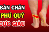 Người có 3 điểm này trên bàn chân: Không thành tỷ phú cũng là đại gia